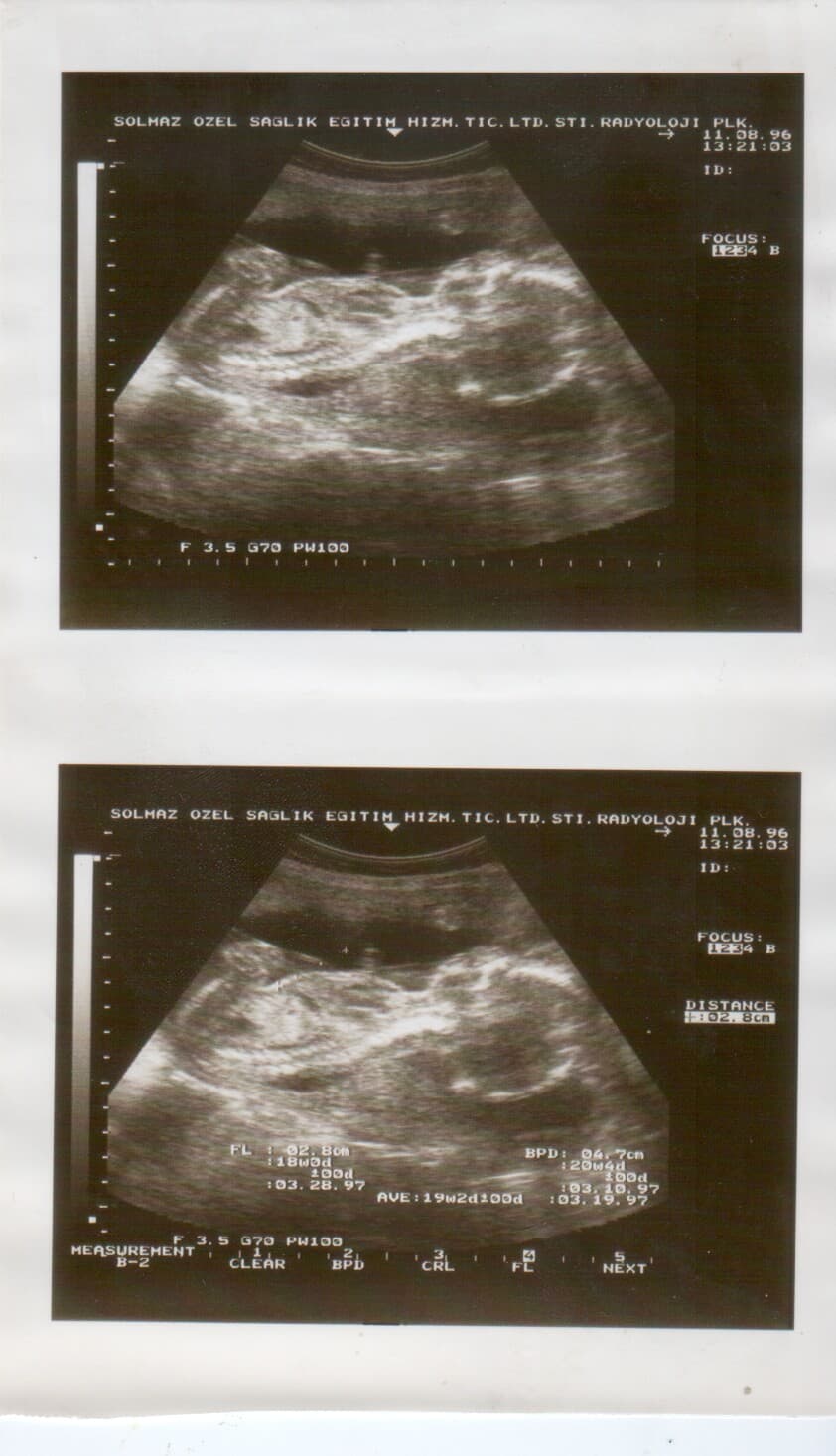 Ultrasound scan detail